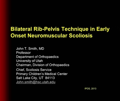Bilateral Rib-Pelvis Technique in Early Onset Neuromuscular Scoliosis - POSNAcademy