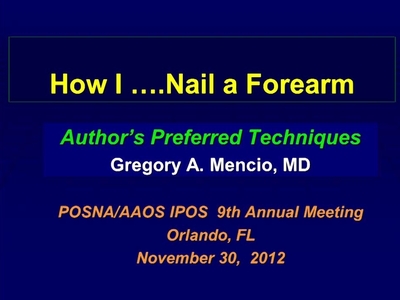 How I Nail a Forearm - POSNAcademy