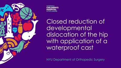 Closed Reduction of Developmental Dislocation of the Hip with