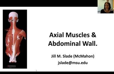 Muscles of back  BioDigital Anatomy