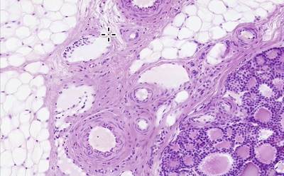 Q2 Thyroid Fat Vessels - MSU MediaSpace