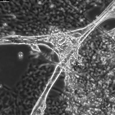 NMJ co-culture spontaneous myotube contraction (Video 2) - mmutube