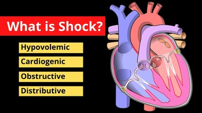 Shock Explained in 120 Seconds | Treatment, Symptoms, Causes | Video ...