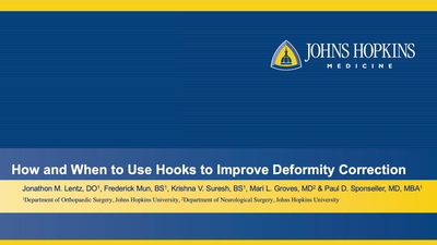 How and When to Use Hooks to Improve Deformity Correction - POSNAcademy