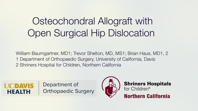 Osteochondral Allograft with Open Surgical Hip Dislocation - POSNAcademy