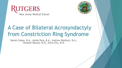 Video Abstract 12: A Case of Bilateral Acrosyndactyly from Constriction ...