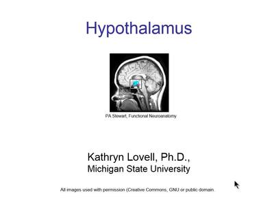 ABLE_11A-Hypothal_Lovell - MSU MediaSpace